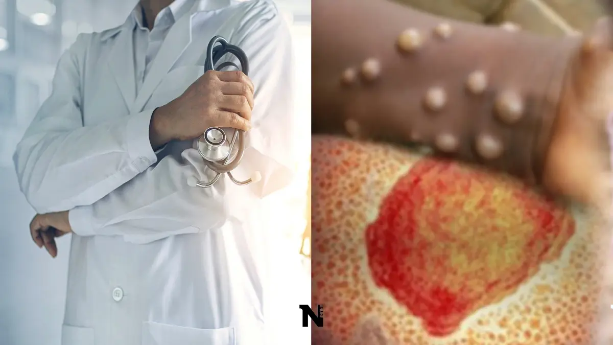 สปสช. ไขข้อสงสัย หากติด"ฝีดาษลิง" ใช้สิทธิรักษาได้แค่ไหน มีขั้นตอนอย่างไร สปสช. ไขข้อสงสัย หากติด"ฝีดาษลิง" ใช้สิทธิรักษาได้แค่ไหน มีขั้นตอนอย่างไร