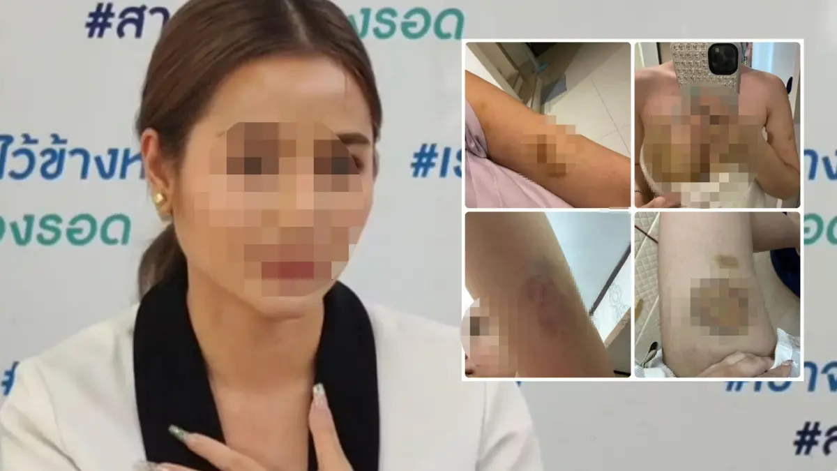 สาวไฮโซ ร้องกระทรวงยุติธรรม ถูกอดีตสามีทำร้าย - ข่มขู่