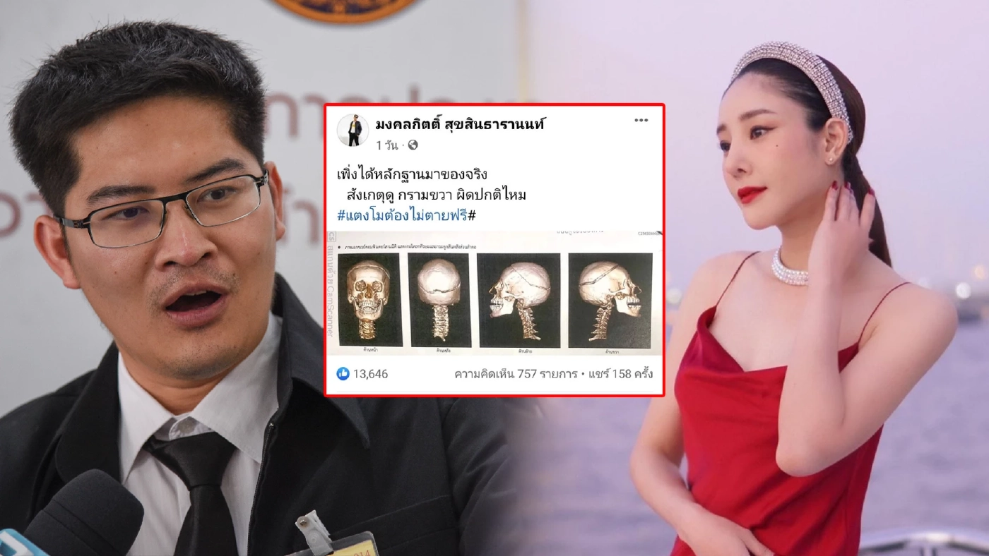 "เต้ มงคลกิตติ์" โพสต์ภาพ อ้างเป็นหลักฐานใหม่คดี "แตงโม นิดา"กรามมีรอยร้าว