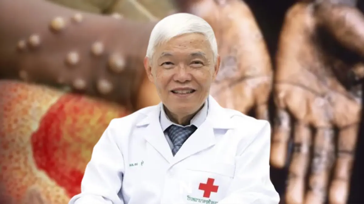 หมอยง เปิดข้อมูล "ฝีดาษลิง" เหตุใดตุ่มจึงขึ้นบริเวณอวัยวะเพศ และป้องกันยาก หมอยง เปิดข้อมูล "ฝีดาษลิง" เหตุใดตุ่มจึงขึ้นบริเวณอวัยวะเพศ และป้องกันยาก