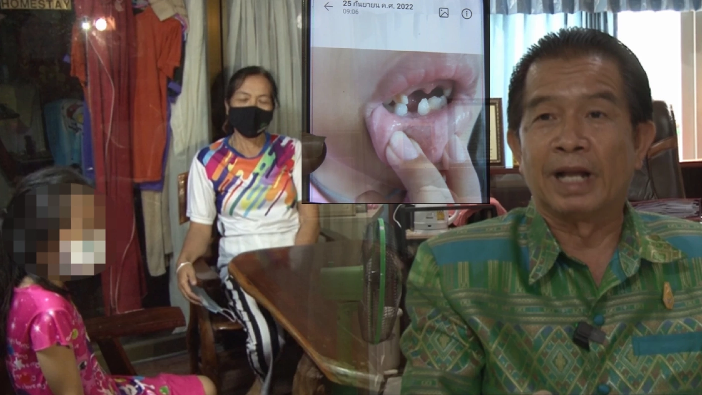 "หนังคนละม้วน” ยายร้องครู รร.ดังนาแก ตบหลานฟันหลุด ขณะที่ รร.โต้ ไม่จริง "หนังคนละม้วน” ยายร้องครู รร.ดังนาแก ตบหลานฟันหลุด ขณะที่ รร.โต้ ไม่จริง