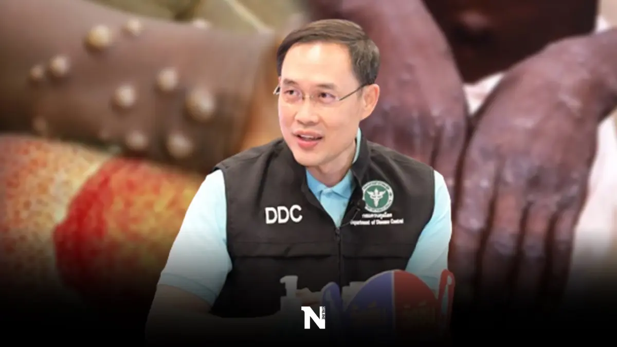 กรมควบคุมโรค เปิดผลตรวจชาวกินี ไม่พบติดเชื้อ "ฝีดาษลิง" กรมควบคุมโรค เปิดผลตรวจชาวกินี ไม่พบติดเชื้อ "ฝีดาษลิง"
