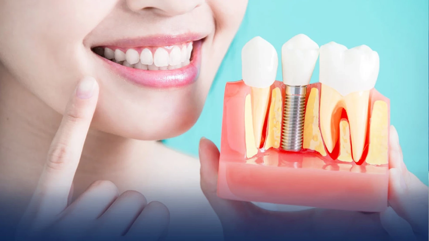 เริ่มแล้ว ใส่ฟันเทียมและรากฟันเทียม ฟรี ทุกสิทธิการรักษา จำนวน 72,000 ราย