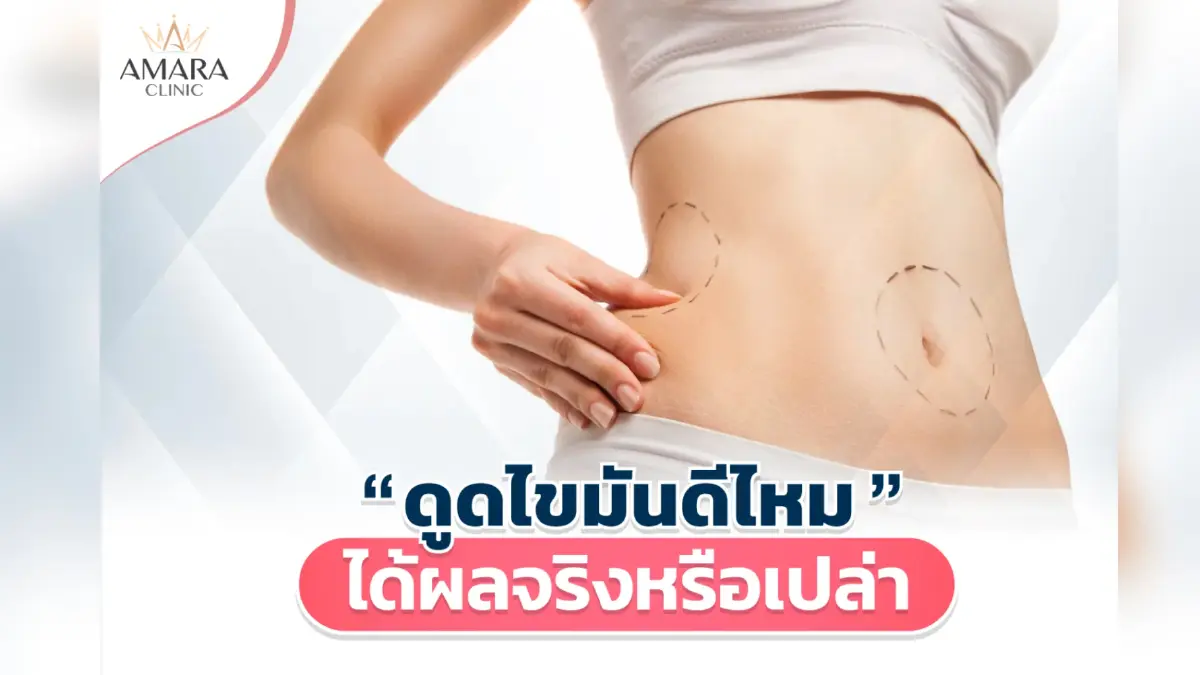 ดูดไขมัน ดีไหม ได้ผลจริงหรือเปล่า ดูดไขมัน ดีไหม ได้ผลจริงหรือเปล่า
