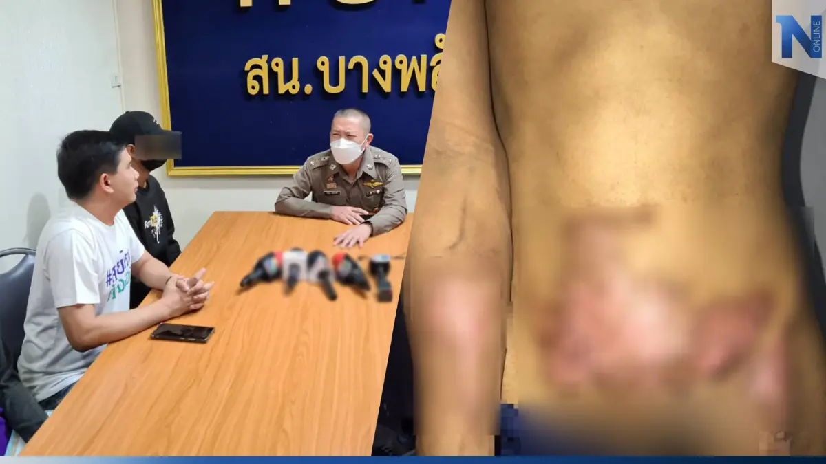 ตำรวจจ่อแจ้งข้อหารุ่นพี่ "รับน้องโหด" ใช้สีสเปรย์ฉีดจุดไฟเผาร่างเฟรชชี่ ตำรวจจ่อแจ้งข้อหารุ่นพี่ "รับน้องโหด" ใช้สีสเปรย์ฉีดจุดไฟเผาร่างเฟรชชี่