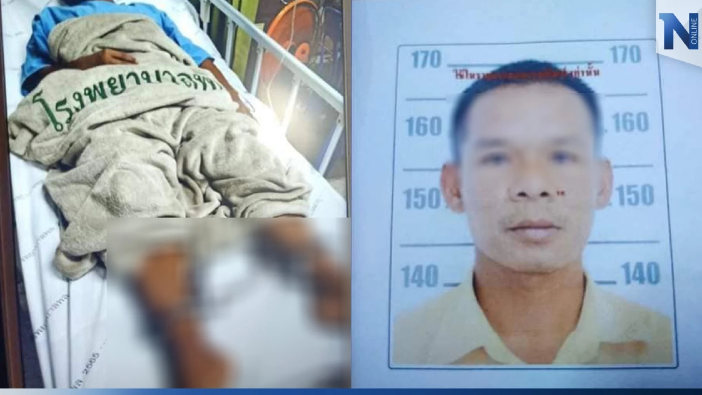 ระดมล่า! นักโทษชาย หลบหนีพร้อมโซ่ตรวน ขณะเข้ารักษาตัวที่ รพ.พล