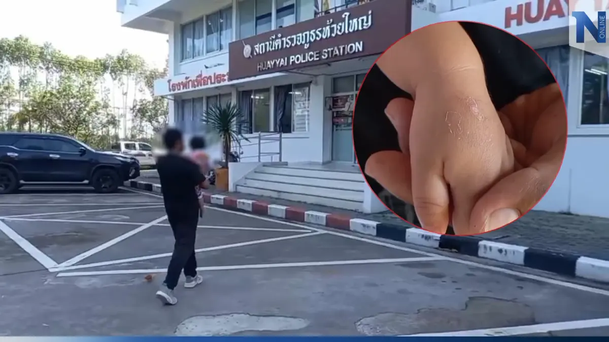 พ่อใจสลาย ลูกสาววัย 2 ขวบ ถูกพี่เลี้ยงทารุณ โร่แจ้งตำรวจเอาผิด