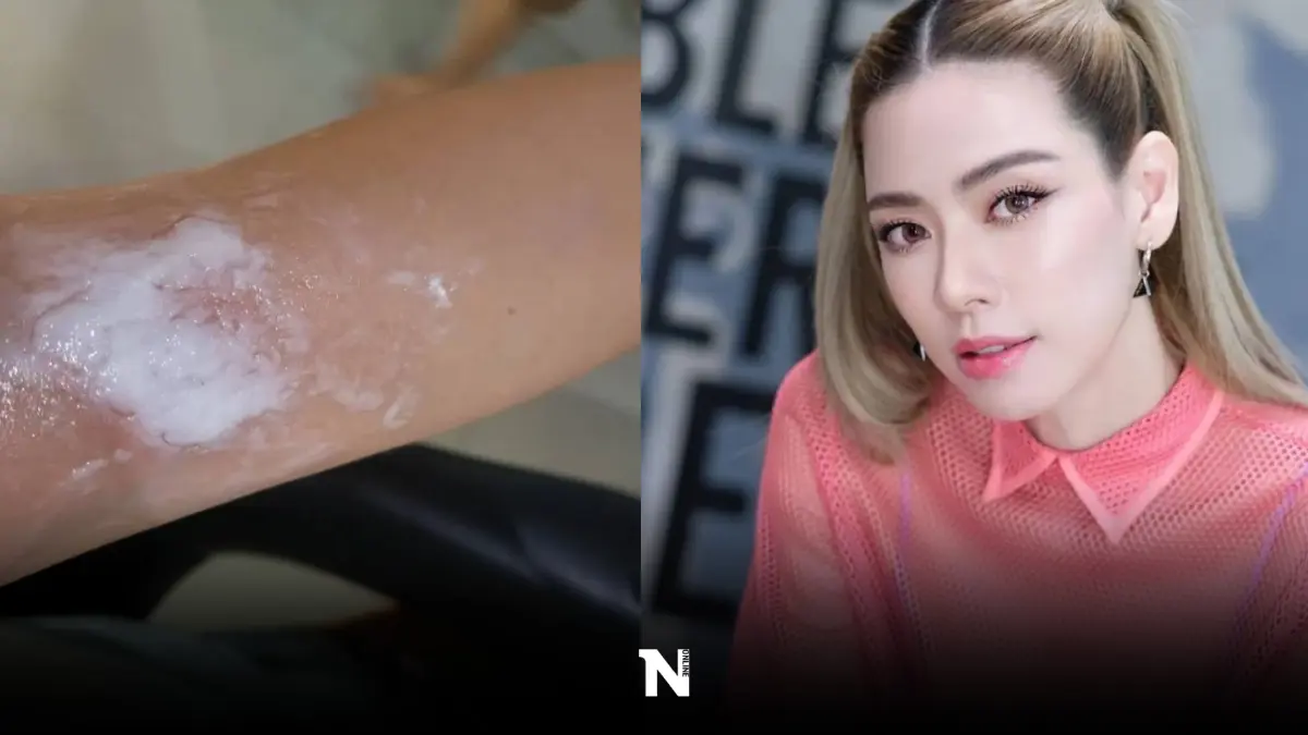 ลอยกระทงเป็นเหตุ คุณแม่ลูกสอง “เอ๋ พรทิพย์ สกิดใจ” เกิดอุบัติเหตุจนได้ ลอยกระทงเป็นเหตุ คุณแม่ลูกสอง “เอ๋ พรทิพย์ สกิดใจ” เกิดอุบัติเหตุจนได้