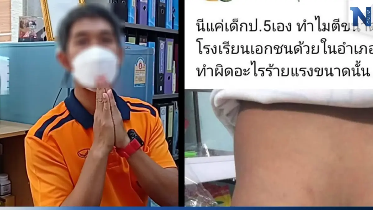 โผล่อีก! แม่ร้องครูเอกชนชื่อดังเมืองพิมาย ตีลูกชาย ป.5 ถึง 26 ครั้งจนก้นลาย