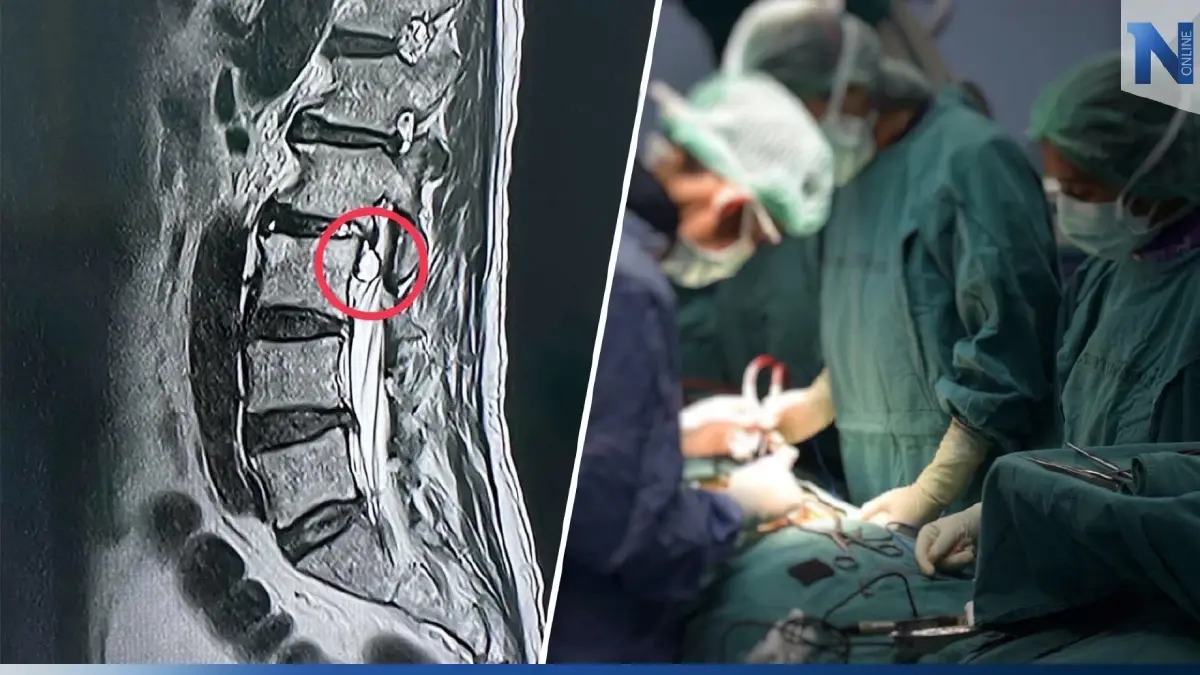 ‘ปวดหลังร้าวลงขา’ รู้ตัวช้าเสี่ยงขาอ่อนแรง ‘ปวดหลังร้าวลงขา’ รู้ตัวช้าเสี่ยงขาอ่อนแรง