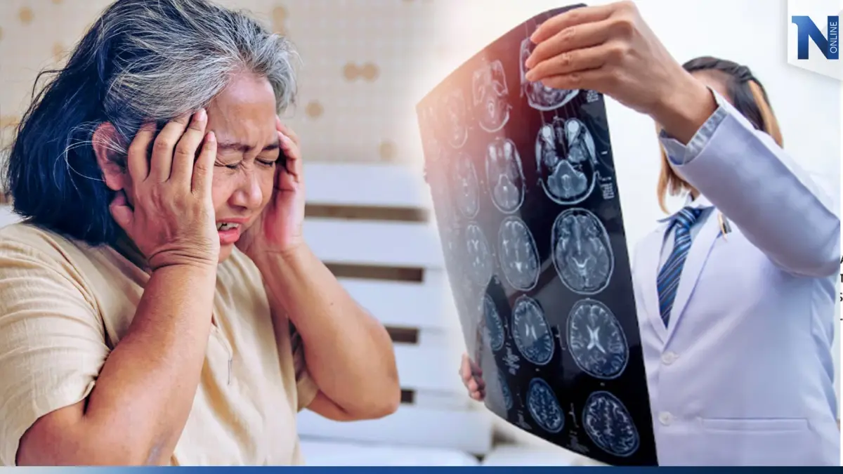 โรคหลอดเลือดสมอง (Stroke) รู้ทันป้องกันอัมพาต โรคหลอดเลือดสมอง (Stroke) รู้ทันป้องกันอัมพาต