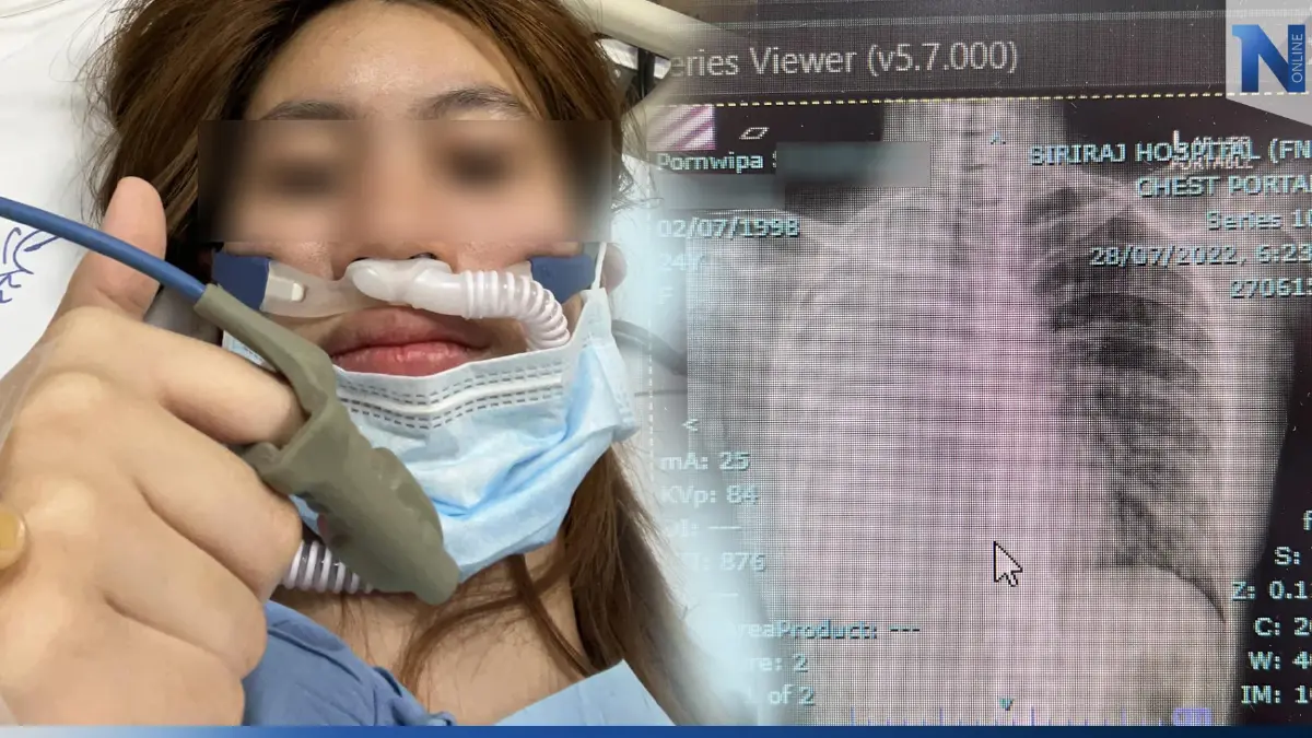 สุดช็อก! พยาบาล 24 ปี ป่วย“มะเร็งปอดระยะสุดท้าย” เชื่อสาเหตุบุหรี่มือสอง