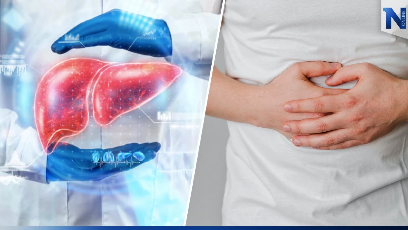 ‘ไขมันพอกตับ’ กลุ่มโรคกินดีอยู่ดีที่สร้างปัญหา