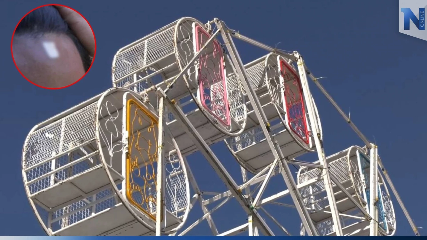 หวิดโศกนาฎกรรม! ประตูชิงช้าสวรรค์หลุด ร่วงมา 10 เมตร ทับหนุ่มวัย 21 เจ็บ หวิดโศกนาฎกรรม! ประตูชิงช้าสวรรค์หลุด ร่วงมา 10 เมตร ทับหนุ่มวัย 21 เจ็บ