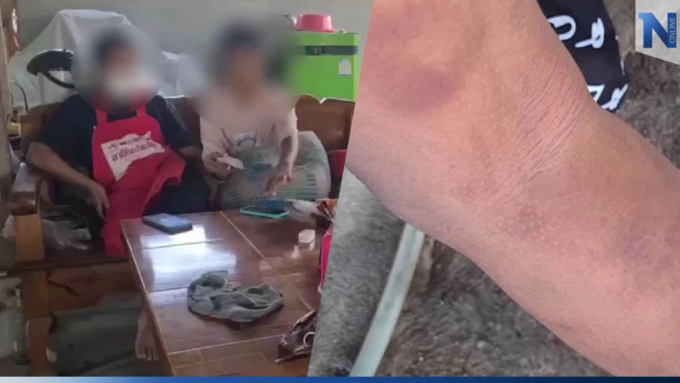 แม่พา ม.2 แจ้งความ ครูสอนนาฎศิลป์ ใช้ไม้กระบองหวดน่อง เพราะจำท่ารำไม่ได้