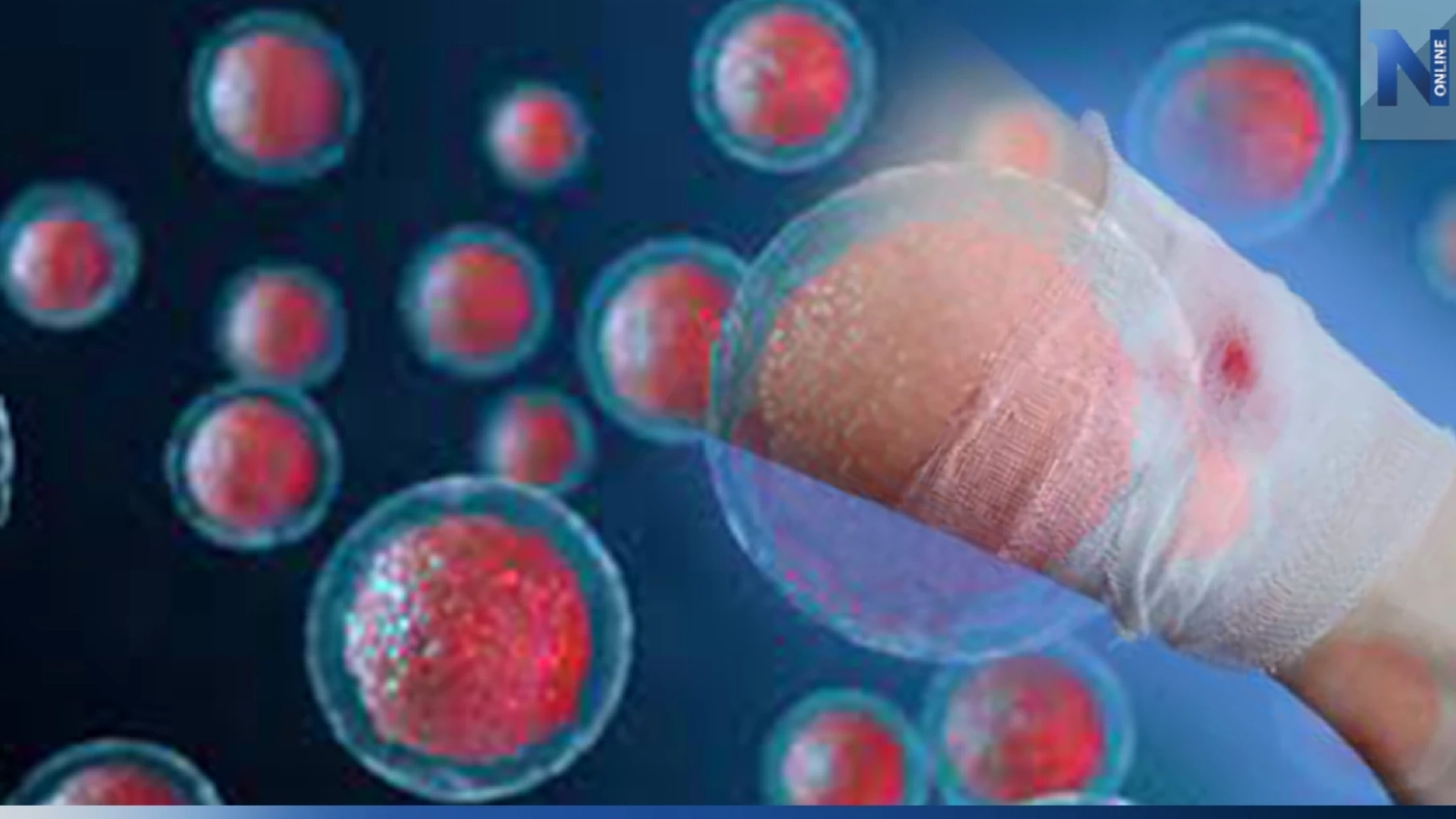 เปิดนวัตกรรม "สเต็มเซลล์" จากเลือดตัวเอง เพื่อรักษาแผลเบาหวาน