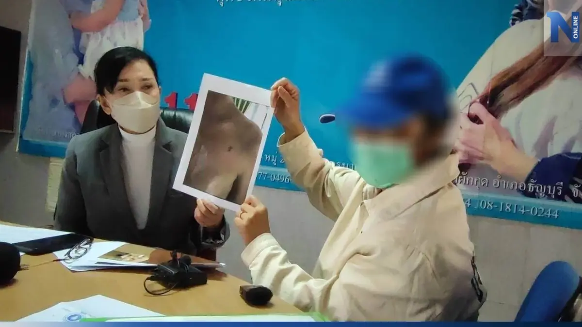 แม่ร้องปวีณา ส่งลูกชายออทิสติก ไปอยู่สถานรับเลี้ยง ถูกครูทำร้าย-มีดแทงอก