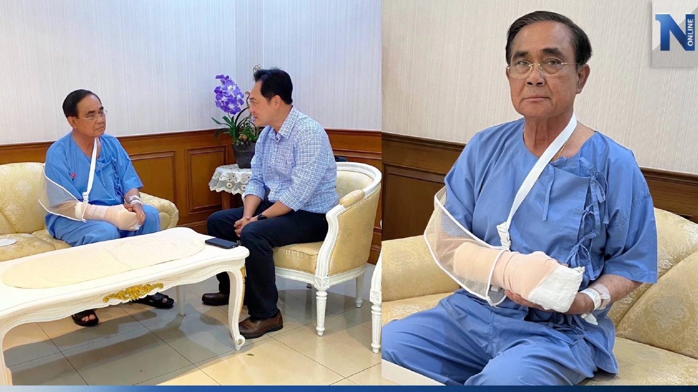 "นายกฯ" รุดตรวจปวดบวมมือขวา แพทย์เข้าเฝือกอ่อนให้ สั่งงดภารกิจตจว. 5-7 วัน "นายกฯ" รุดตรวจปวดบวมมือขวา แพทย์เข้าเฝือกอ่อนให้ สั่งงดภารกิจตจว. 5-7 วัน