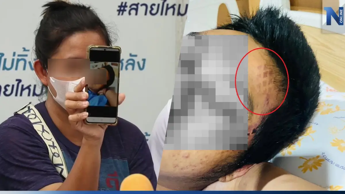 พี่สาวร้องเพจสายไหมฯ น้องชายถูกรุมจนสลบ ปลุกมาทำร้ายซ้ำ คดีไม่คืบหน้า