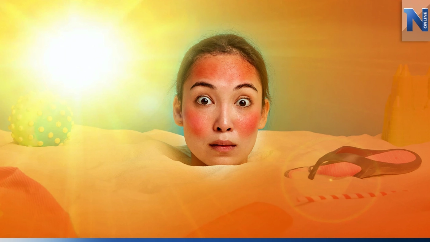 ผิวไหม้แสบพังหลังออกแดด แพทย์ผิวหนังแนะวิธีฟื้นฟูฉบับเร่งด่วน