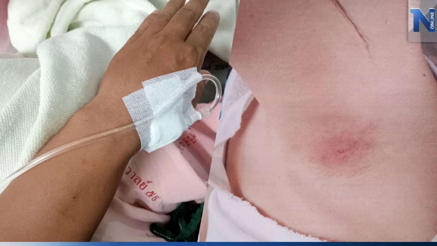 ลูกจ้างสาวท้อง โดนนายจ้างทำร้ายสาหัส สูญเสียลูก ตร.ไม่รับแจ้งความ