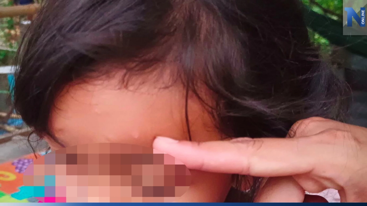 บีบหัวใจ! แม่ร้องลูก ป.2 โดนครูโยนหนังสือใส่หัวเลือดซึม แค่ทำการบ้านผิด