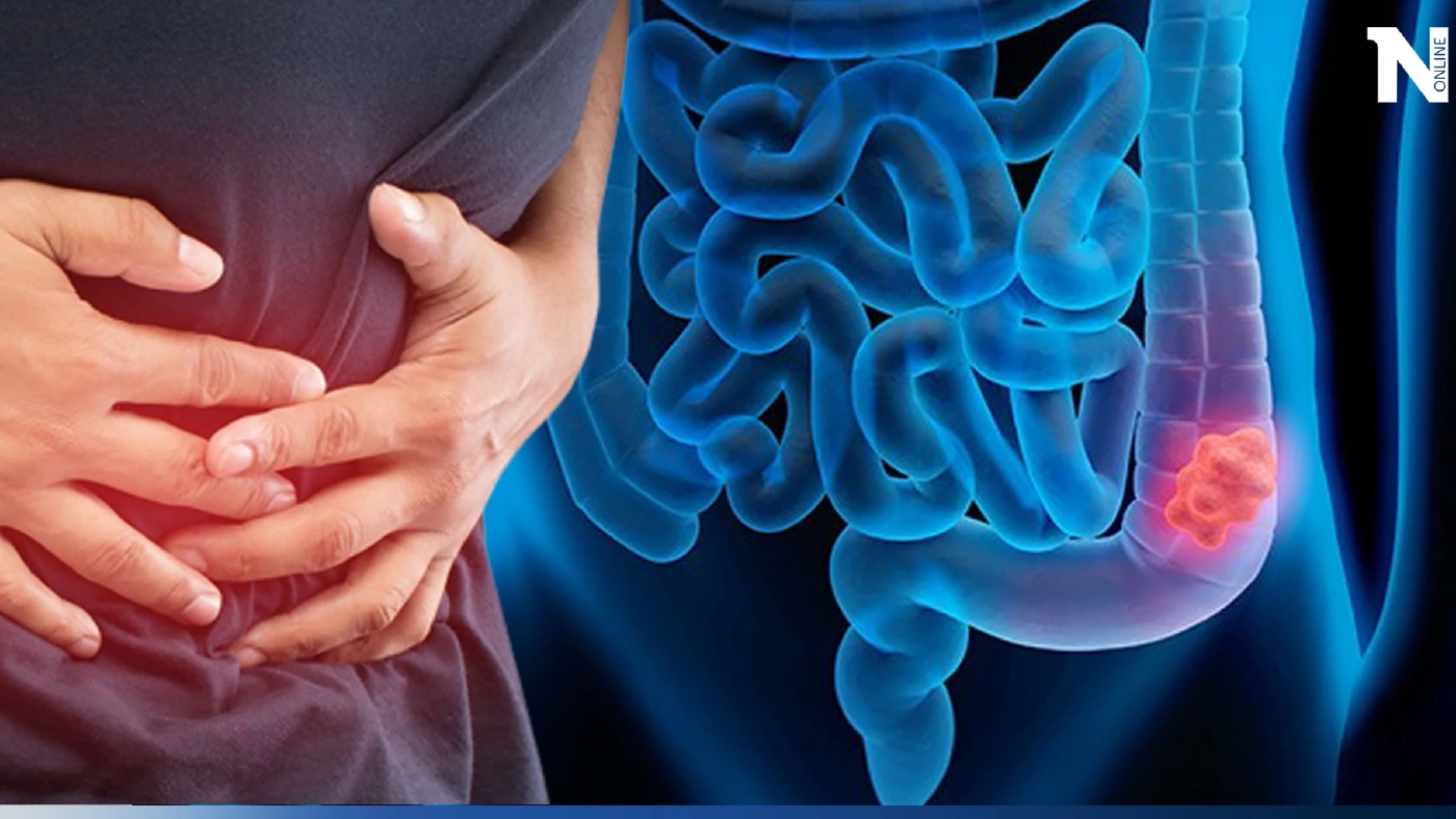 เช็กอาการ สัญญาณเตือน มะเร็งลำไส้ใหญ่ รีบพบแพทย์ด่วน ก่อนสายเกินไป