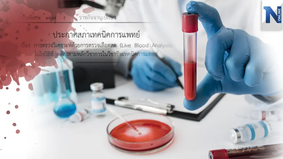 "ตรวจเลือดสด"ไม่ใช่วิธีถูกต้องตามมาตรฐาน สภาเทคนิคการแพทย์ ออกประกาศใช้