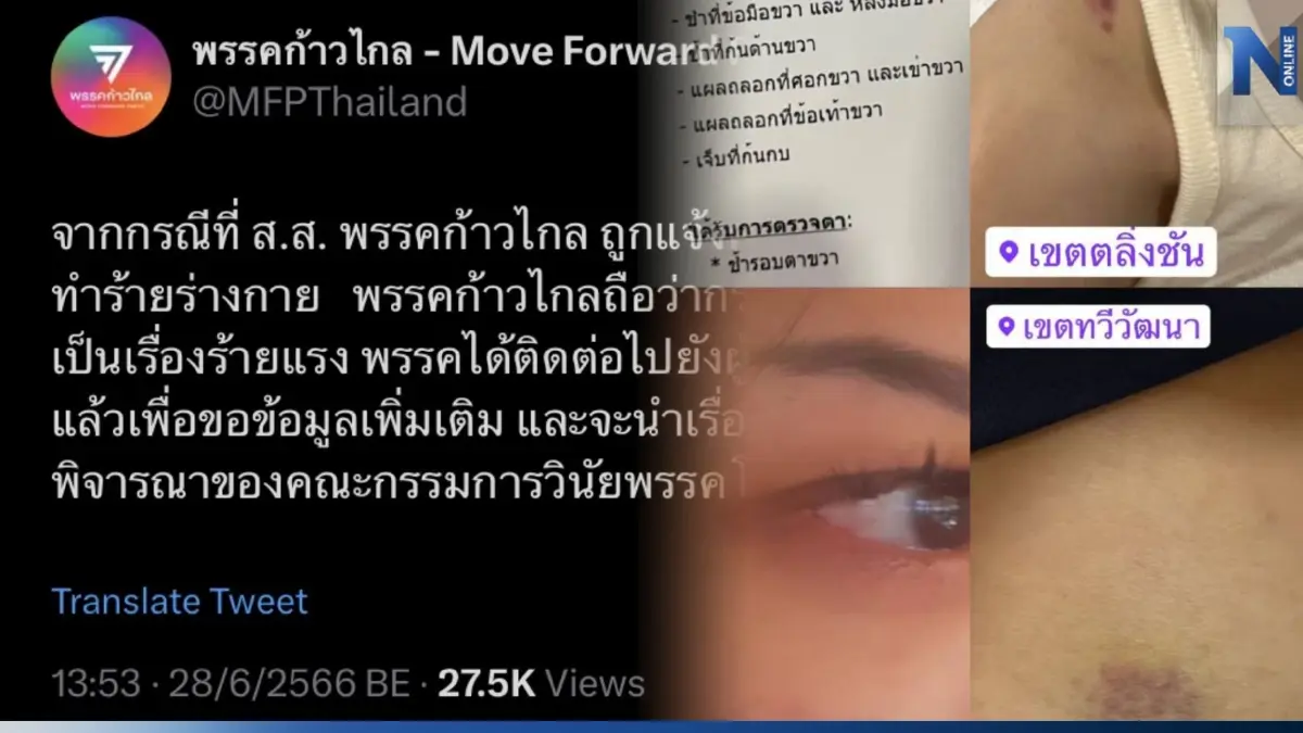 ฉาวอีก "ส.ส.ก้าวไกล" ซ้อมแฟนสาวเจ็บหนัก ตร.นัดให้ปากคำ 2 ก.ค. นี้