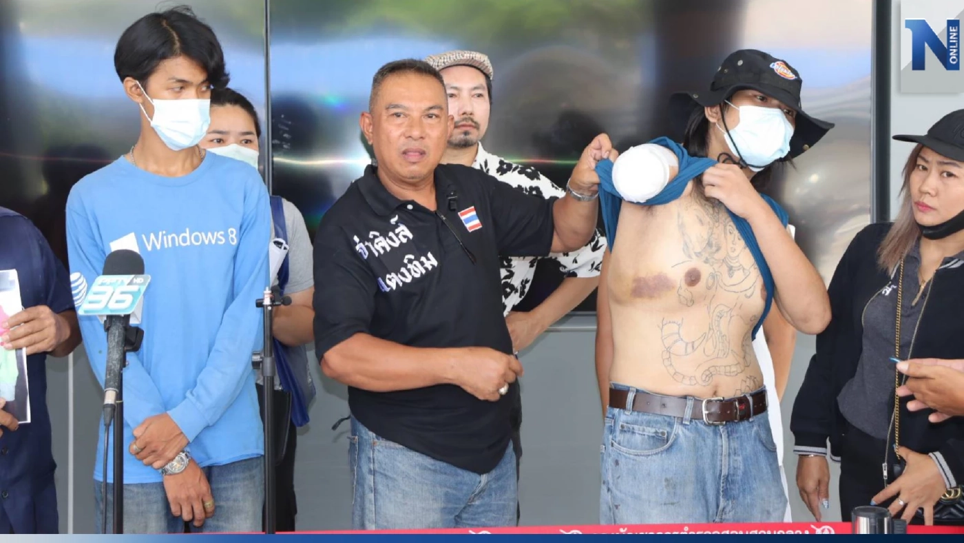 ร้องกองปราบ ลูกชายถูกยิงแขนขาดคดีไม่คืบ คนร้ายยังลอยนวล