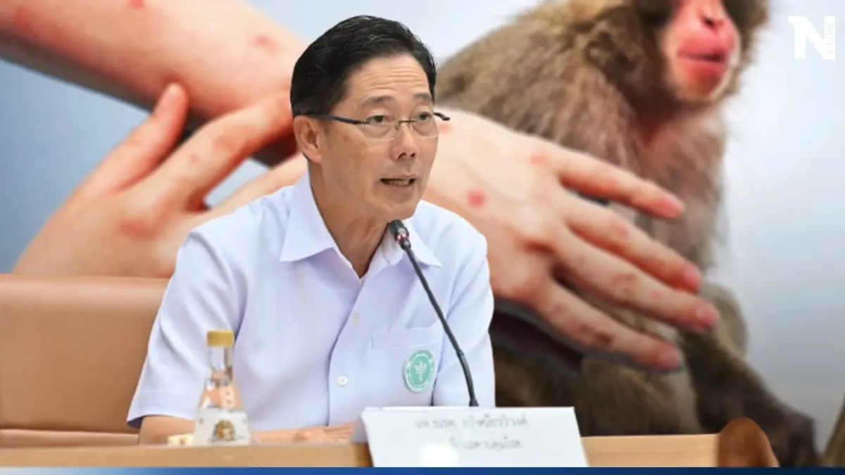 อัปเดตโรคฝีดาษลิง เสียชีวิตเพิ่ม 1 ราย ล่าสุดยอดติดเชื้อในไทยพุ่ง 385 ราย 