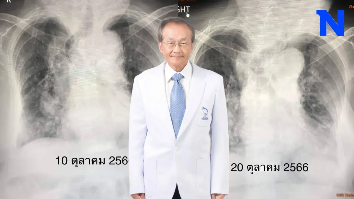 "หมอมนูญ" เตือนดังๆ ไข้หวัดใหญ่ระบาดหนัก แนะนำให้รีบไปฉีดวัคซีน "หมอมนูญ" เตือนดังๆ ไข้หวัดใหญ่ระบาดหนัก แนะนำให้รีบไปฉีดวัคซีน