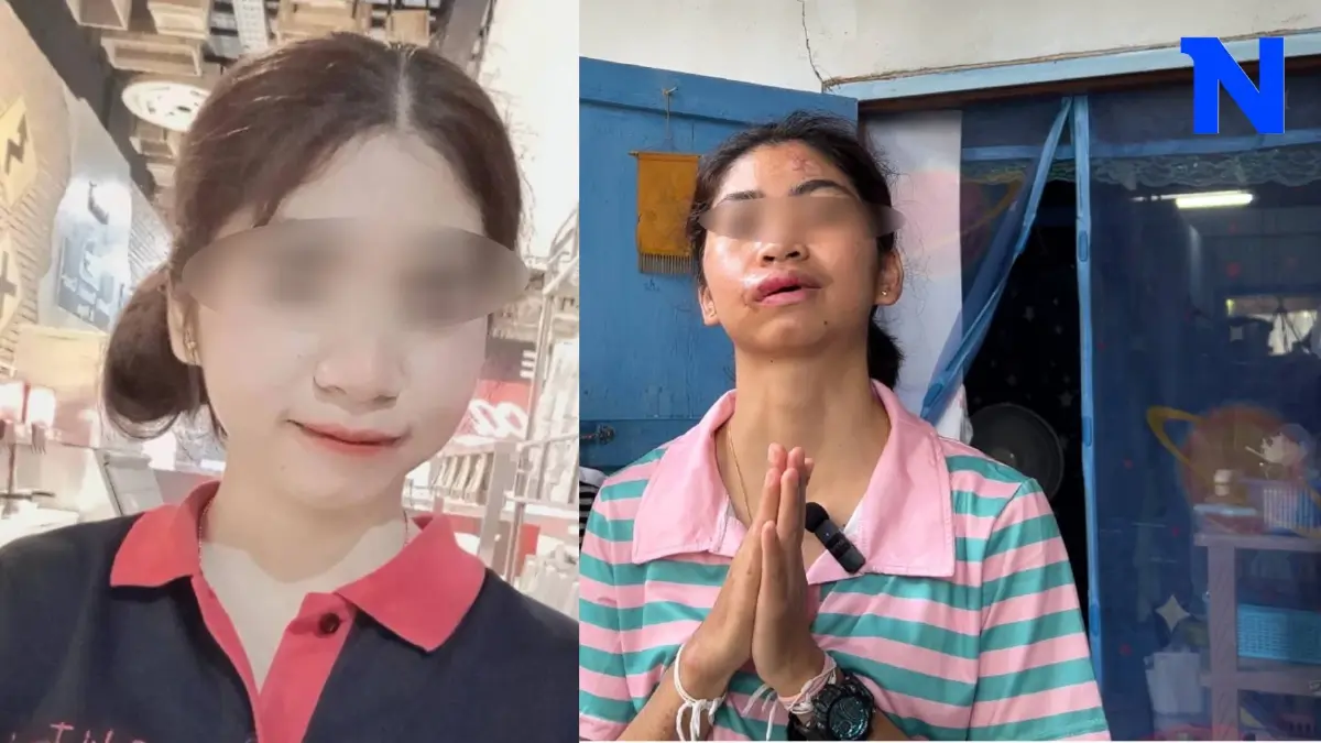 สาว ปวส.ปี 2 ร้องสื่อ ถูกกระบะชน เจ็บสาหัส หน้าเสียโฉม คู่กรณีไร้เยียวยา
