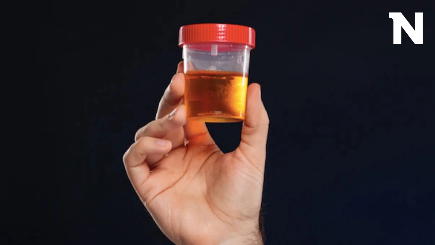 ปัสสาวะมีกลิ่นฉุนผิดปกติเกิดขึ้นได้อย่างไร และเสี่ยงเป็นโรคอะไรได้บ้าง?