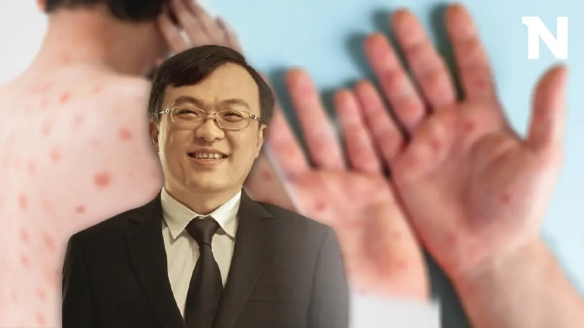 หมอเตือน โรคฝีดาษลิง เสี่ยงแพร่ระบาดตามรอย HIV แพร่เชื้อไปแล้วถึง 37 จังหวัด