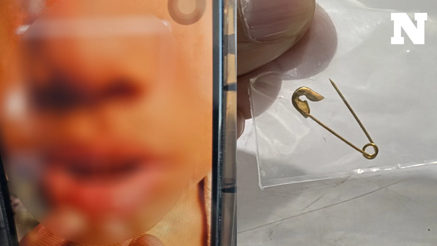 ผู้ปกครองเด็กที่ถูก 'ครูใช้เข็มจิ้มปาก' รับไม่ได้ อยากให้ออกจากการเป็นครู