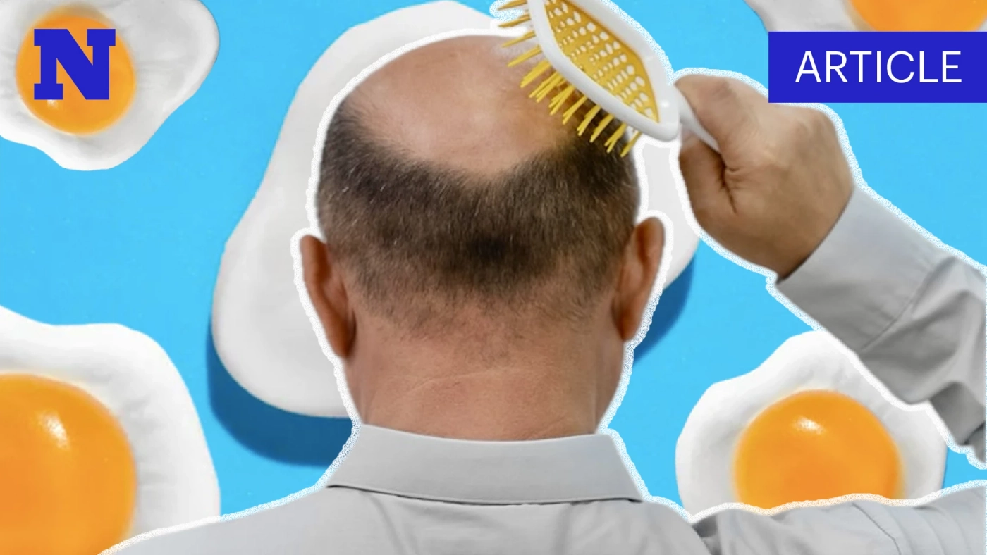 ถาม-ตอบ : ล้างความเชื่อเรื่อง “หัวล้าน” ที่เราเคยได้ยิน จริงหรือมั่ว!!