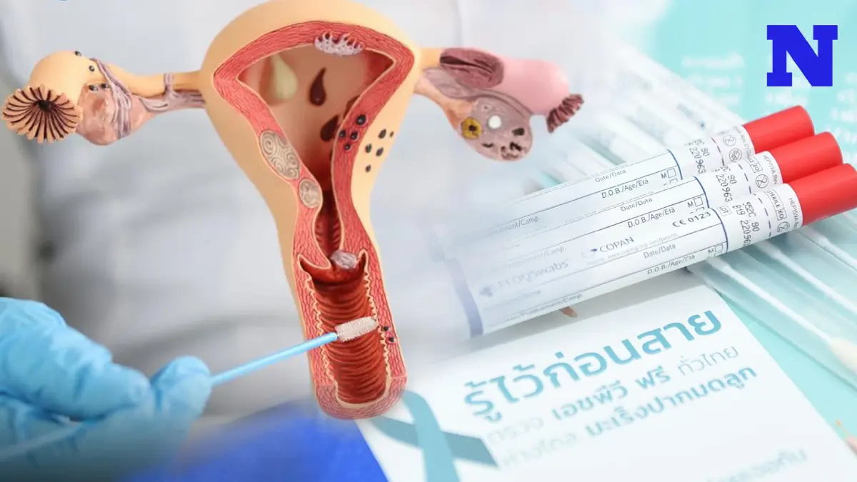 หญิงไทยพบ “มะเร็งปากมดลูก” 15 คนต่อวัน แนะใช้สิทธิเก็บตัวอย่างด้วยตนเองฟรี