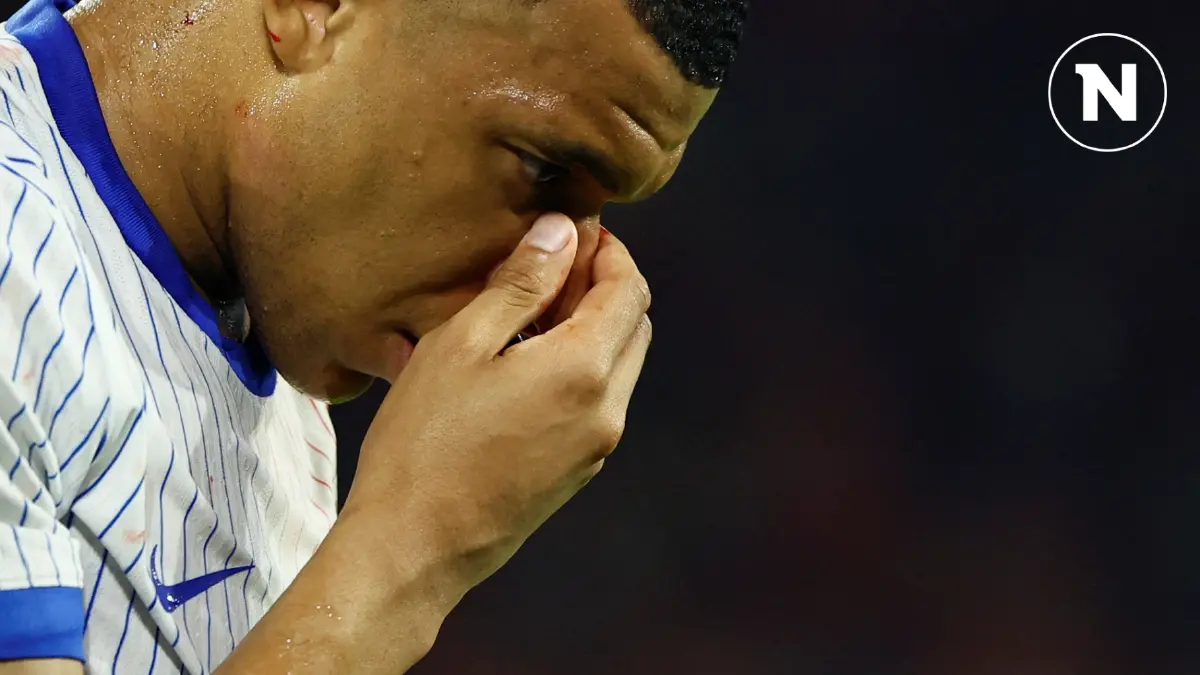 ฝรั่งเศสได้ข่าวดี "เอ็มบัปเป้" ช่วยทีมต่อได้หลังจมูกแตก