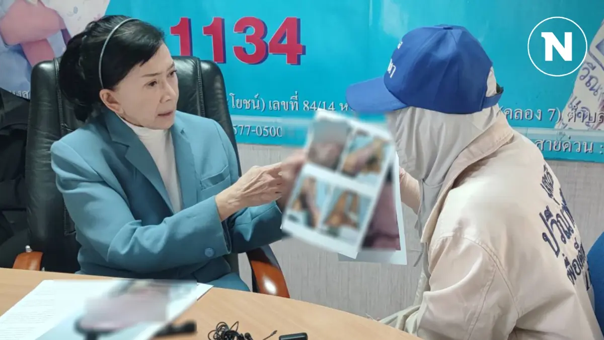 สาวโรงงานถูกแฟนหนุ่ม "สาดน้ำกรดเสียโฉม" ร้อง "ปวีณา" วอนเร่งตามจับ