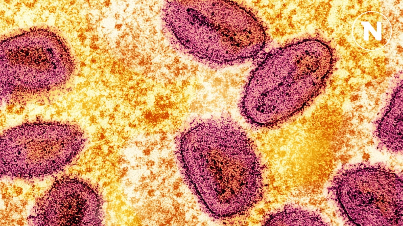 ฟิลิปปินส์พบผู้ป่วยฝีดาษลิง มาเลเซีย-อินโดนีเซียเพิ่มคัดกรองนักเดินทาง