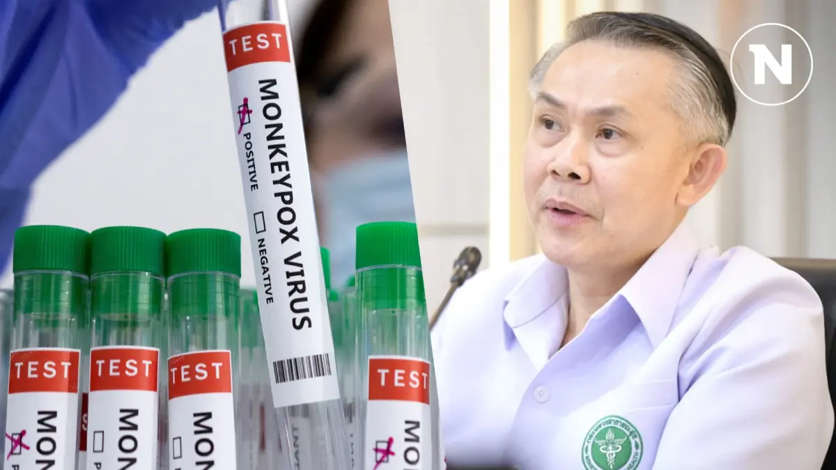 เปิดไทม์ไลน์ ผู้ป่วยสงสัย "ฝีดาษวานร clade 1" รายแรกในไทย เฝ้าระวัง 21 วัน