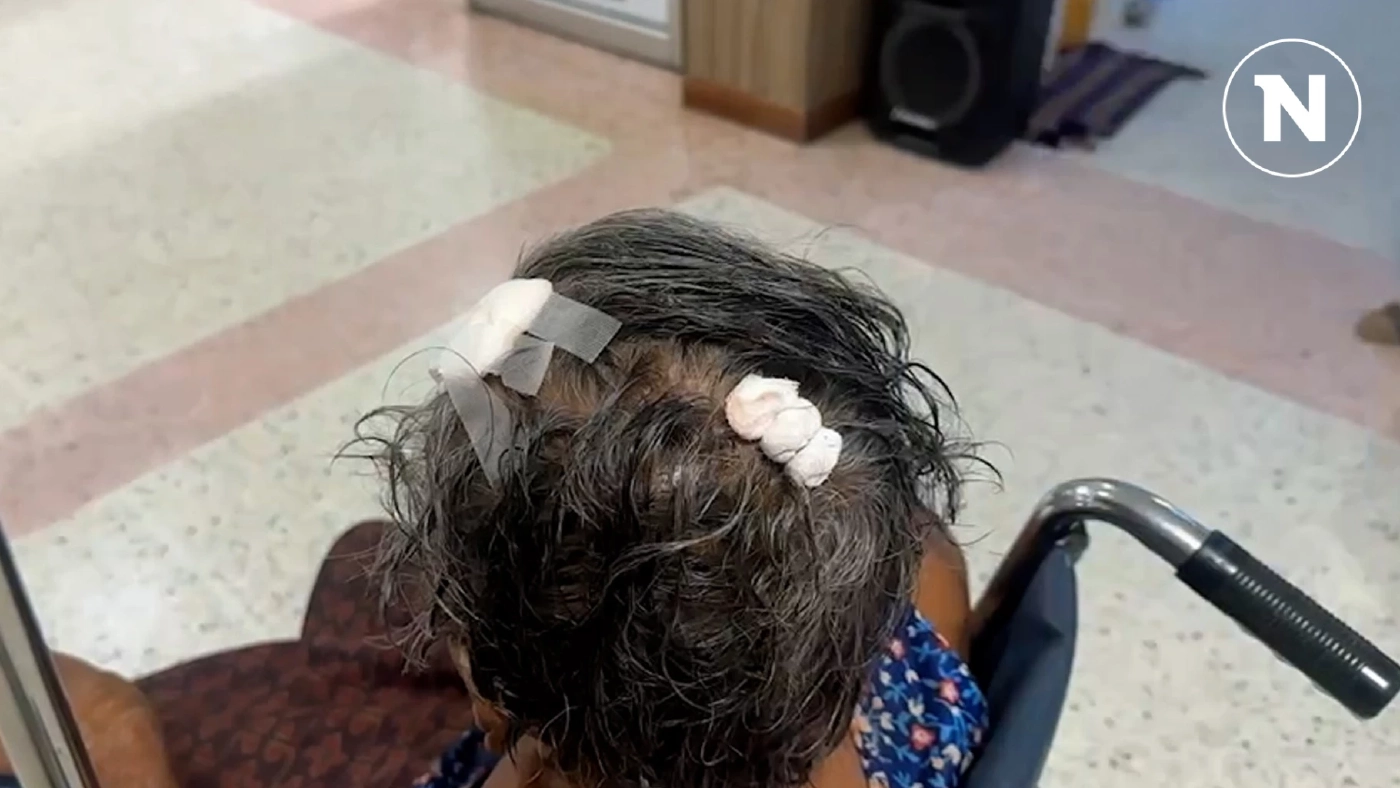 ลูกเทวดา ไม่พอใจแม่วัย 86 บ่น หลังแบ่งเงินดิจิทัลให้ คว้าจานฟาดเลือดอาบ ลูกเทวดา ไม่พอใจแม่วัย 86 บ่น หลังแบ่งเงินดิจิทัลให้ คว้าจานฟาดเลือดอาบ