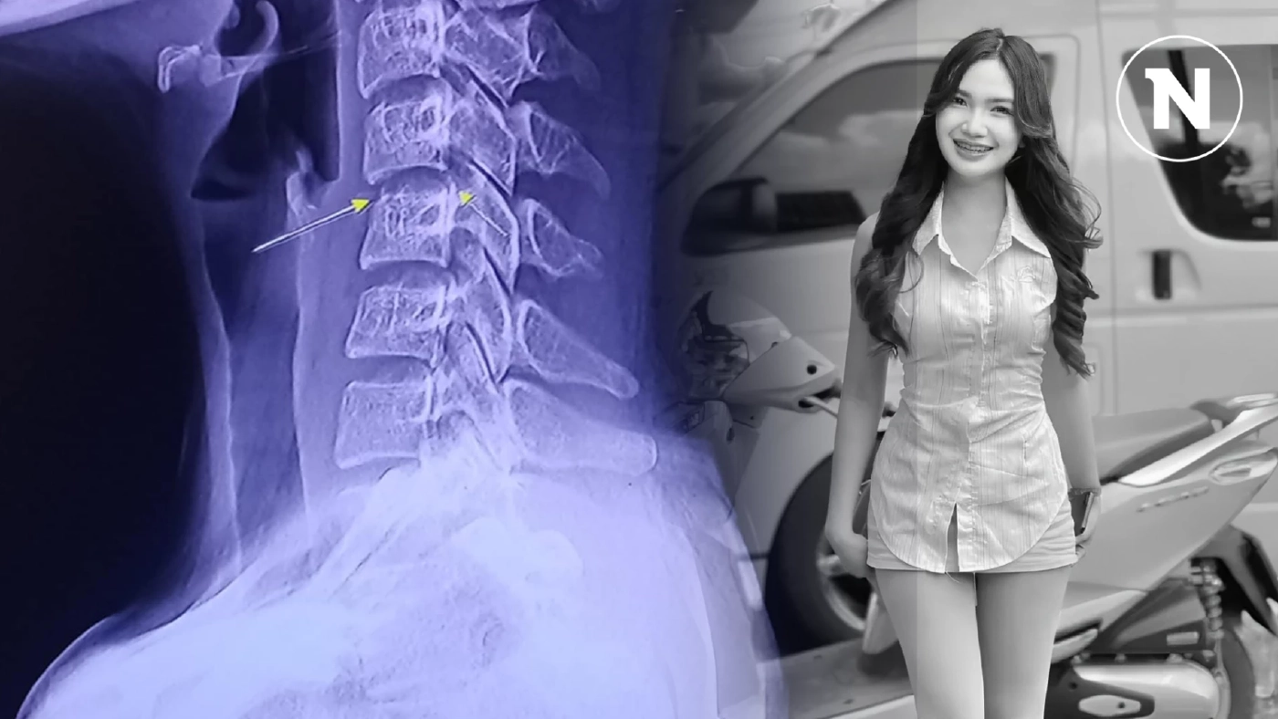 รู้จัก "โรคไขสันหลังอักเสบ" ที่คร่าชีวิต "ผิง ชญาดา" ภัยเงียบรักษาไม่ง่าย