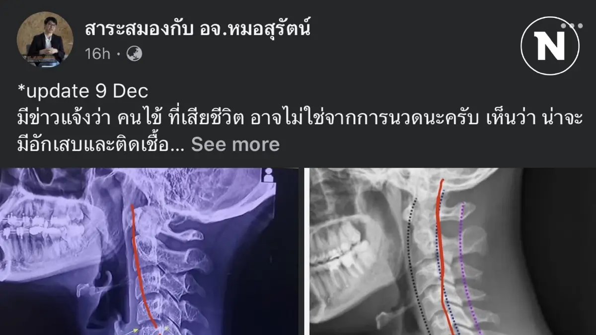 อย่าเพิ่งกลัว เดี๋ยวหมอตกงาน! อ.หมอ ชี้ “ผิง ชญาดา” อาจไม่ได้ดับเพราะการนวด อย่าเพิ่งกลัว เดี๋ยวหมอตกงาน! อ.หมอ ชี้ “ผิง ชญาดา” อาจไม่ได้ดับเพราะการนวด