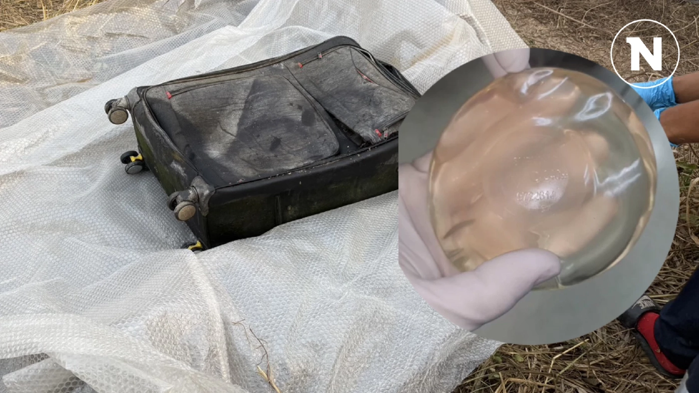 สาวผมแดงถูกยัดกระเป๋า ยิ่งสืบยิ่งยาก ตร.เร่งตามรอยจากจมูกที่เหลา