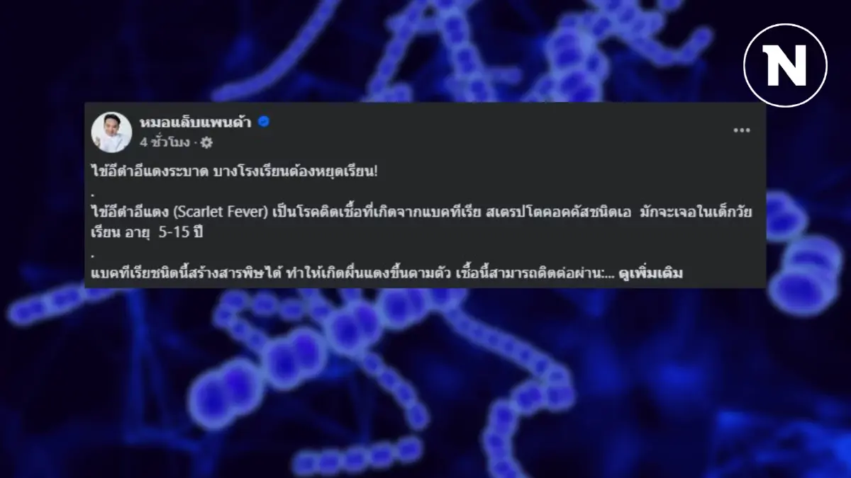 "หมอแล็บ" เตือน ไข้อีดำอีแดงระบาด บางโรงเรียนต้องหยุดเรียน อาการเป็นอย่างไร เช็กที่นี่