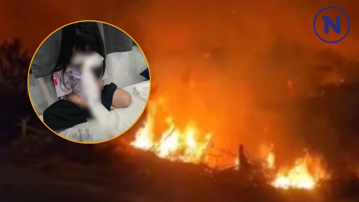 น้องปลาทู ดาราเด็ก อาการหนัก พิษเผาไร่อ้อย เลือดกำเดาไหลถี่ วอนเร่งแก้ไข