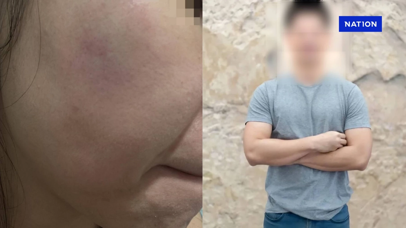 สาว 26 ร้อง ถูกหนุ่มไฮโซชื่อดัง ซ้อมกักขัง แฉพฤติกรรมคล้ายโรคจิต สาว 26 ร้อง ถูกหนุ่มไฮโซชื่อดัง ซ้อมกักขัง แฉพฤติกรรมคล้ายโรคจิต