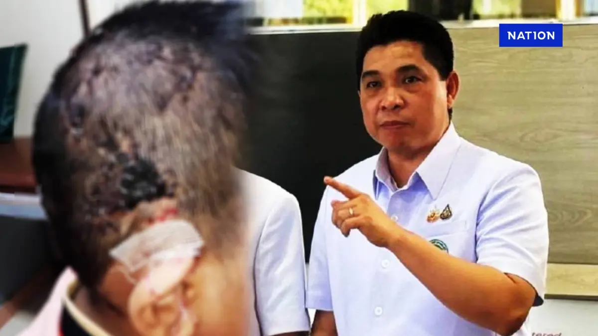 เหยื่อ "พิตบูล" ขย้ำ 10 ขวบ เจ็บสาหัส เตรียมร้อง “ผู้ช่วย รมว.สาธารณสุข” เหยื่อ "พิตบูล" ขย้ำ 10 ขวบ เจ็บสาหัส เตรียมร้อง “ผู้ช่วย รมว.สาธารณสุข”